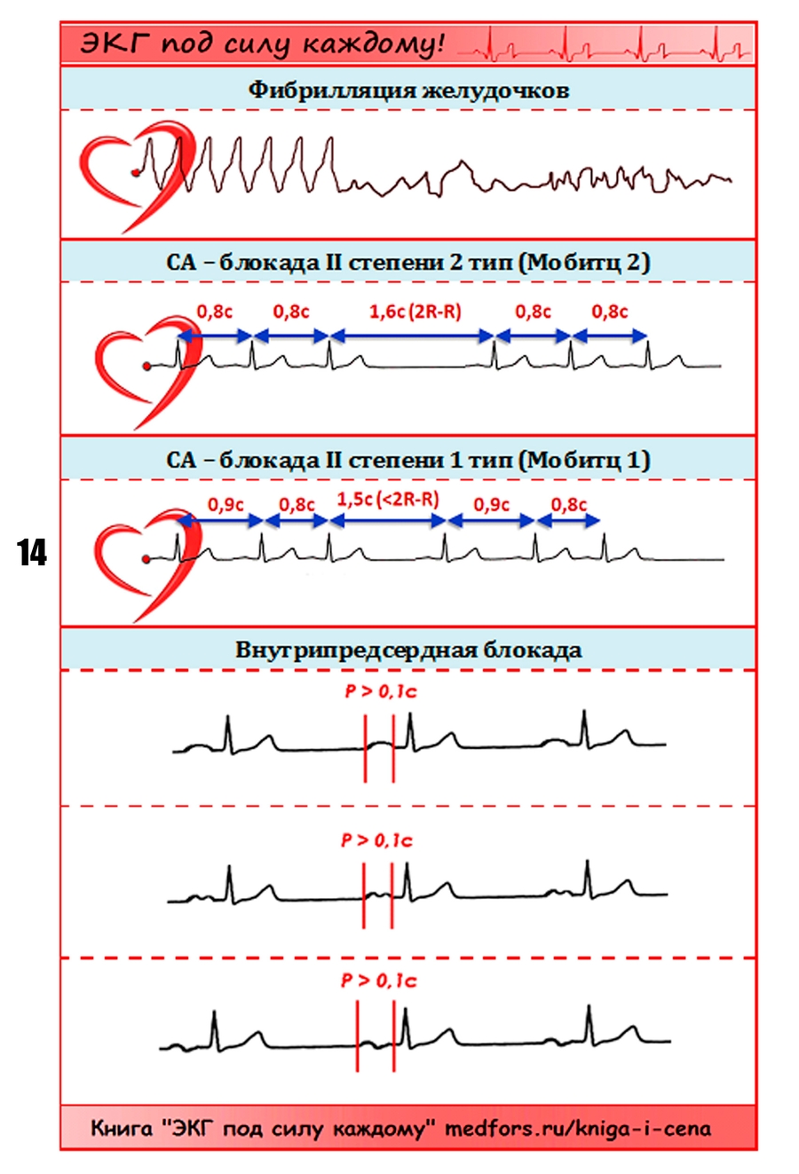 экг под силу каждому pdf